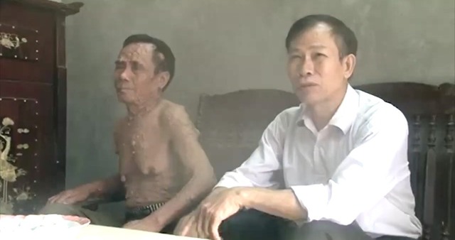 Kỷ niệm 62 năm thảm họa da cam ở Việt Nam (10/8/1961 - 10/8/2023); 15 năm Ngày thành lập Hội Nạn nhân chất độc da cam/ddioxin huyện Mê Linh (10/8/2008-10/8/2023): Mê Linh chung tay xoa dịu nỗi đau da cam - Ảnh 1.