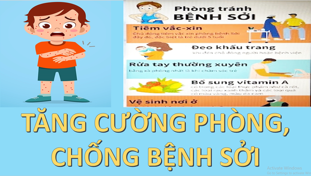 BÀI TUYÊN TRUYỀN PHÒNG BỆNH SỞI- Ảnh 2.